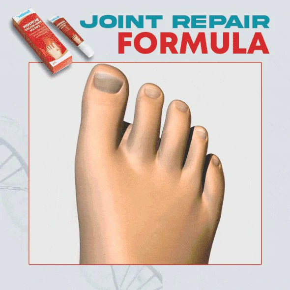 Bunion Relief Cream